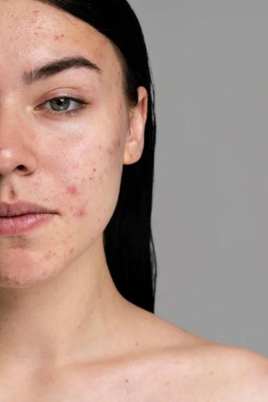 Cracking the Moisturizer Code: Your Guide to Glowing, Healthy Skin